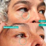 3INA - The Cool Eyes Cream - Ooggel - Verkoelend - 15 ml