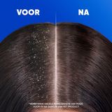 Head & Shoulders Classic Anti Roos Shampoo 1 Pomp