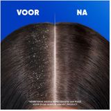 Head & Shoulders - Citrus Fresh - 2-in-1 Anti-roos Shampoo & Conditioner - 400ml