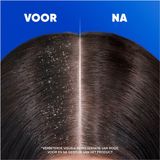 Head & Shoulders - 2-in-1 - Anti-Roos Shampoo - Citrus Fresh - 400ml