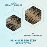 Head & Shoulders - DERMAxPRO Sensitive - Anti-roos Shampoo - 250 ml