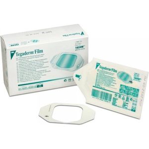 Tegaderm Film - Wondfolie - Transparant - 3M