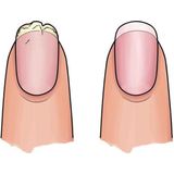 Herome 3 in 1 Manicure met Nagelverharder, Nagellakremover en Nagelriemcreme – Nagelverzorging set