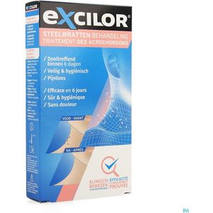 Excilor Wrattenbehandeling van steelwratten - effectief na 6 dagen, pijnloos, hygiënisch