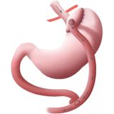 Wapiti Speciaal Multivitamine Na een Gastric Bypass 60 capsules