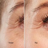 Silk'n - FaceTite Mini - Huidverjongingsapparaat - Anti-aging LED-technologie