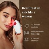 Silk'n - Bright Lux - Gezichtsreiniger - Blauw - 4-in-1 Functie