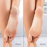 Silk'n - VacuPedi - Elektrische Eeltverwijderaar - Wit - Oplaadbaar via USB-C