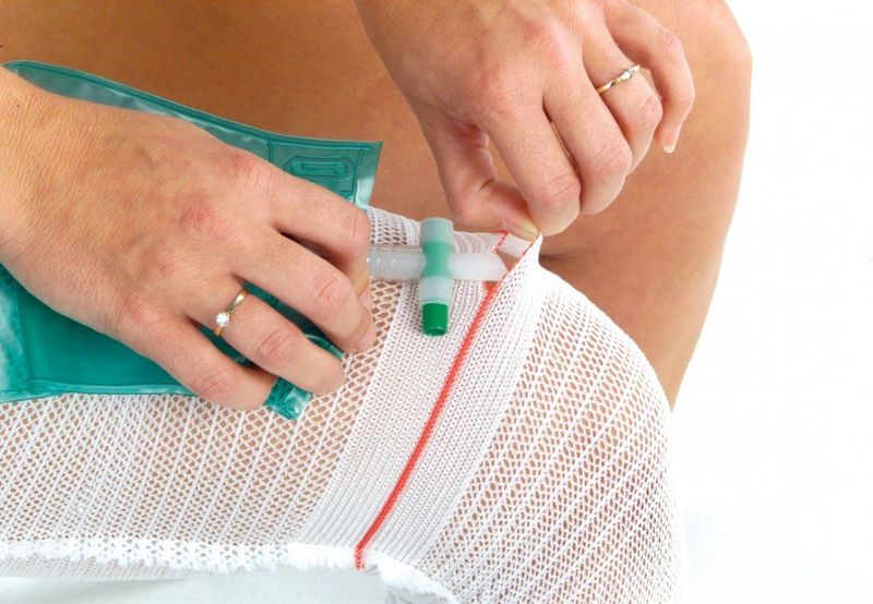 Curion fixette urinebeenzakhouder - Small