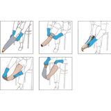 Arion - Minimax - Aantrekhulp - Compressiekousen