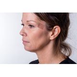 Curetape - Crosslinq - Bandages - Synthetisch - 160 Stuks