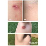 Staudt Wondzalf 20 ml