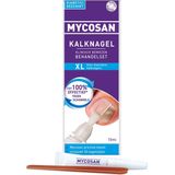 Kalknagelset - Inhoud 1 Precisiekwast 10 Nagelvijlen - Gepatenteerd Serum