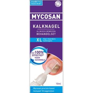 Kalknagelset - Inhoud 1 Precisiekwast 10 Nagelvijlen - Gepatenteerd Serum