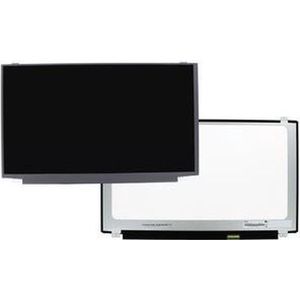LCD Scherm 15.6 inch - Glans - 1366x768 - 30Pin eDP - Geschikt voor Laptops
