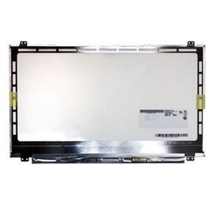 15.6 Inch LCD Scherm 1920x1080 Mat 40Pin