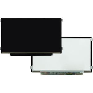 11.6 inch LCD scherm 1366x768 mat 40Pin