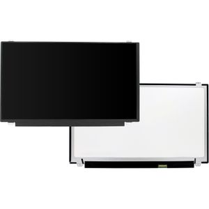 OEM - 15.6 Inch LCD Scherm - Glans - 1366x768 - 30Pin eDP