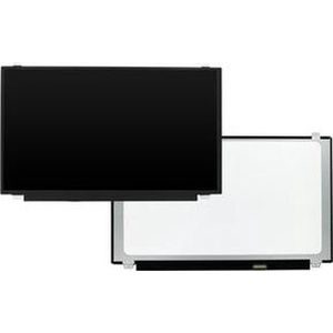 15.6 inch LCD Scherm 1366x768 Mat 30Pin eDP