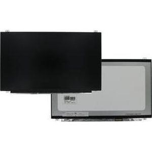 15.6 Inch LCD Scherm 1920x1080 Mat 30Pin eDP