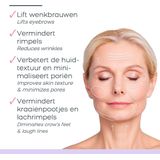Derma Wand PRO Huidsverzorgingsapparaat Anti-aging Microdermabrasie - Huidsimulatie - Gezichtsmassage