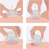 Fasciq - Cellulite Cups - Cupping for cellulite - Set van 4