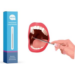 MiBrush Amandelstenen Verwijderen - Tonsil stones verwijderaar voor stukjes, brokjes uit de keel