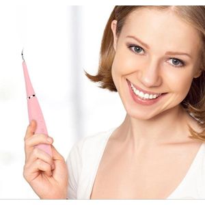 Elektrische Tandsteen Verwijderaar ROZE – Mondverzorging – Gebitsreiniging - Tandsteen Verwijderen Elektrisch – Tandreiniger - Tandplak Verwijderaar ROZE