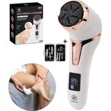 Beeperfect - Elektrische Eeltverwijderaar - Voetvijl - Inclusief 6 Eeltschijven - IPX7 Waterdicht