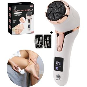 Beeperfect® Elektrische Eeltverwijderaar met Stofzuigsysteem - Voetvijl - Eeltvijl - IPX7 Waterdicht - Inclusief 6 Eeltschijven - Gratis pedicure set
