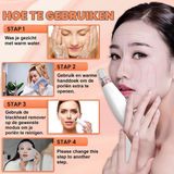 TibaGoods Premium Blackhead Remover - Poriënreiniger - 6 Opzetstukken