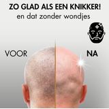 Sansbeauté - Skull Sharp PRO - Scheerapparaat - Draadloos - Nat & Droog