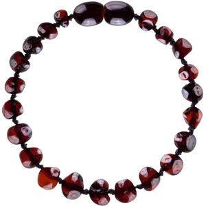 Wild Sun Barnsteen Armband Baby / Peuter - Amber Enkelbandje - Baltische Barnsteen – Pijnstillend bij Doorkomende Tanden - 14 cm - Cherry