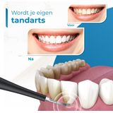 V-Goods - Professionele Tandsteen Verwijderaar - 5 Standen - Inclusief 3 Opzetstukken