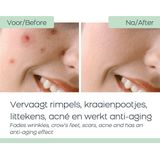 Orange Care Baba de Caracol slakkencrème Dagcrème 50 ml