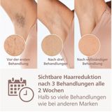 Philips - Lumea 9000 Series - Ontharingsapparaat - Gesatineerd Roze