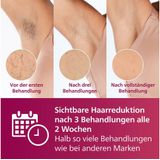 Philips - Lumea Advanced - Ontharingsapparaat - Wit - IPL-technologie