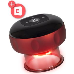 Nuvance - Elektrische Cupping Cups - Draadloos - 12 Standen - Warmtefunctie