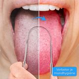 Tongschraper Set - RVS - 3 Varianten - Compact en Reisvriendelijk