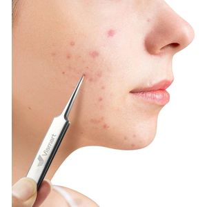 Ultrafijn Pincet - Tweezer - RVS - Huidverzorging - Verwijderen van Haartjes, Puistjes, Mee-eters, Splinters en Teken.