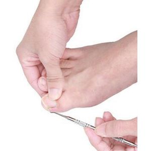 Teen Nagellifter I Nagellifter I Ingegroeide Teennagel Corrector I Nagel Correctie Kit I Nagelheffer I RVS