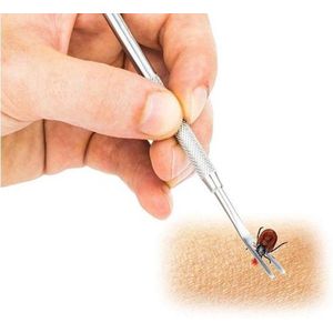 CHPN - Tekentang - Tekenpincet - Ticktool - Teek verwijderaar - Huisdieren en mensen - Teek weghalen - Lyme - RVS