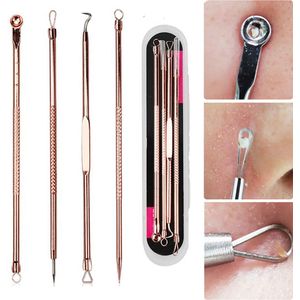 Comedonenlepels - 4-Delige Set - RVS - Rozegoud - Acne en Mee-eters Verwijderen