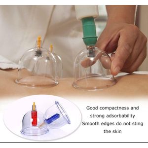 IBBO® - Chinese Cupping - Vacuum cups - Massage - Cupping Set - Cupping Set Massage - Cups - Set 12-Delig