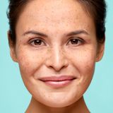 Biodermal - Couperose Creme - 30 ml - Medisch Hulpmiddel