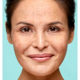 Biodermal - Oogcrème - 15 ml - Verzachtend - 2x