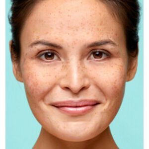 Biodermal - Oogcrème - 15 ml - Verzachtend - 2x