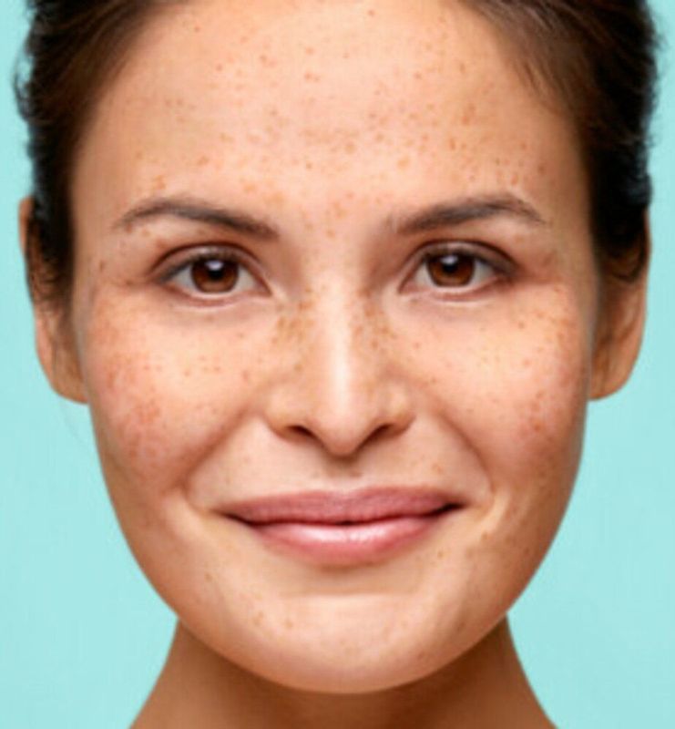 Biodermal - Oogcrème - 15 ml - Verzachtend - 2x