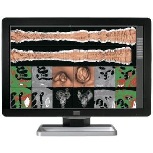 Microsoft Surface Laptop 3 - Intel Core i7-10e Generatie - 13 inch - Touch - 16GB RAM - 256GB SSD - Windows 11 Home + 2x 22 inch Monitor Nette Staat