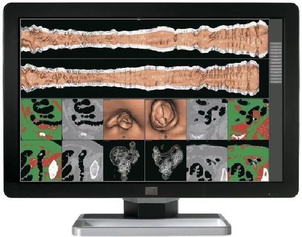 Microsoft Surface Laptop 3 - Intel Core i7-10e Generatie - 13 inch - Touch - 16GB RAM - 256GB SSD - Windows 11 Home + 2x 22 inch Monitor Nette Staat